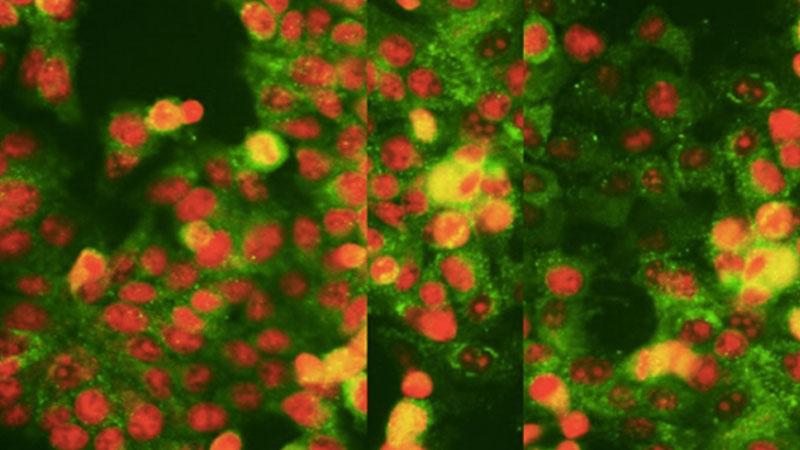 cancer research