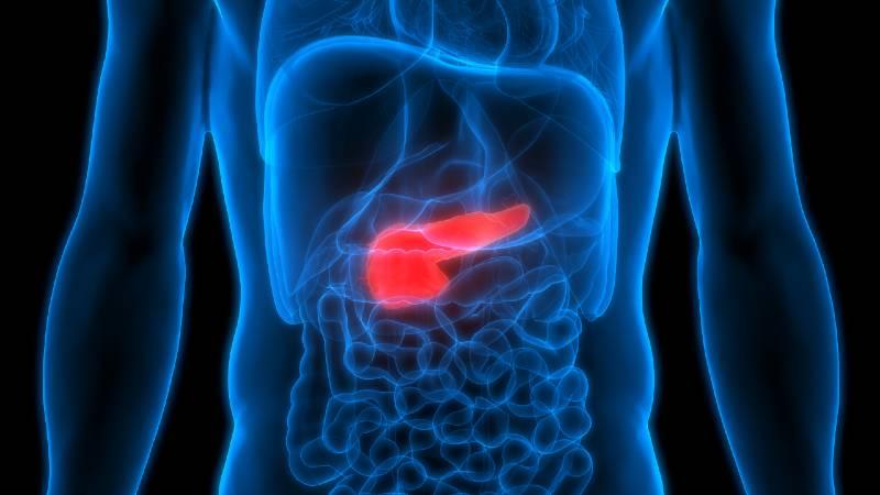 Pancreatic cancer