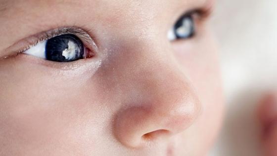 Close up of a baby's eyes