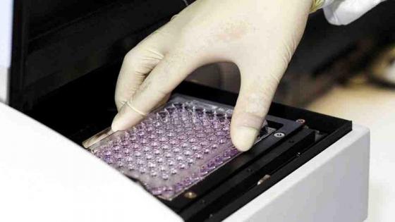 Researcher is running a blood test research